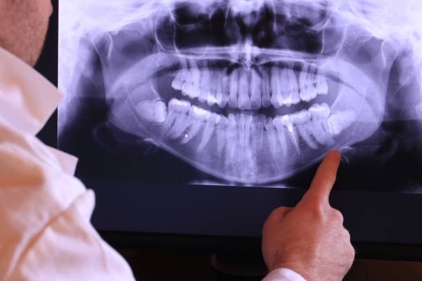 Best Walk-In Emergency Dentist in Lawrence, MA