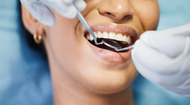 Best Emergency Root Canal Treatment in Lawrence, MA